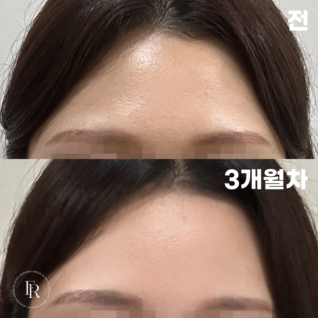 13a043e58398abfdfdb5645f353569e8_1772085012_8926.jpg 13a043e58398abfdfdb5645f353569e8_1772085012_8926.jpg