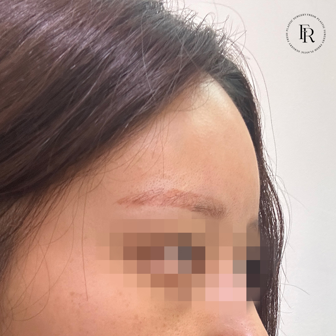 13a043e58398abfdfdb5645f353569e8_1772085149_9311.jpg 13a043e58398abfdfdb5645f353569e8_1772085149_9311.jpg