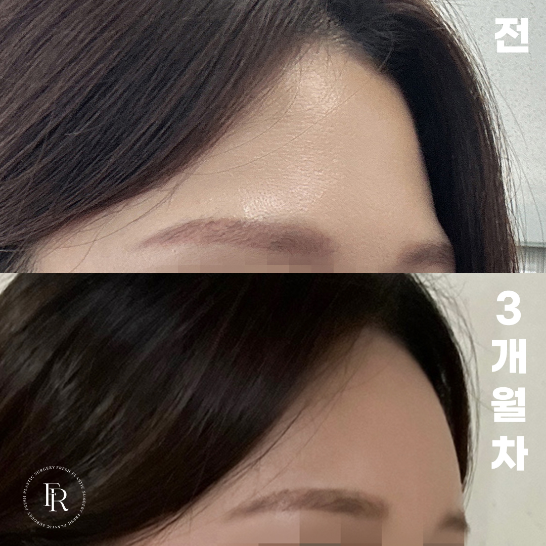 13a043e58398abfdfdb5645f353569e8_1772085265_5149.jpg 13a043e58398abfdfdb5645f353569e8_1772085265_5149.jpg