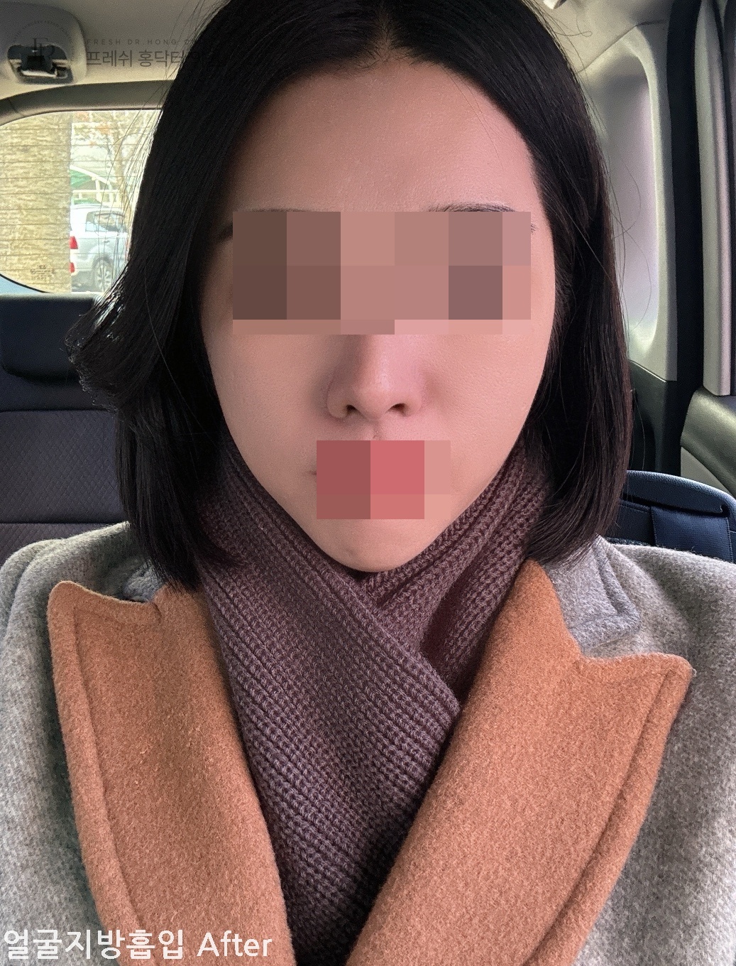 74d699094b67a155c2c55972202f7bc0_1773800010_0501.jpg 74d699094b67a155c2c55972202f7bc0_1773800010_0501.jpg