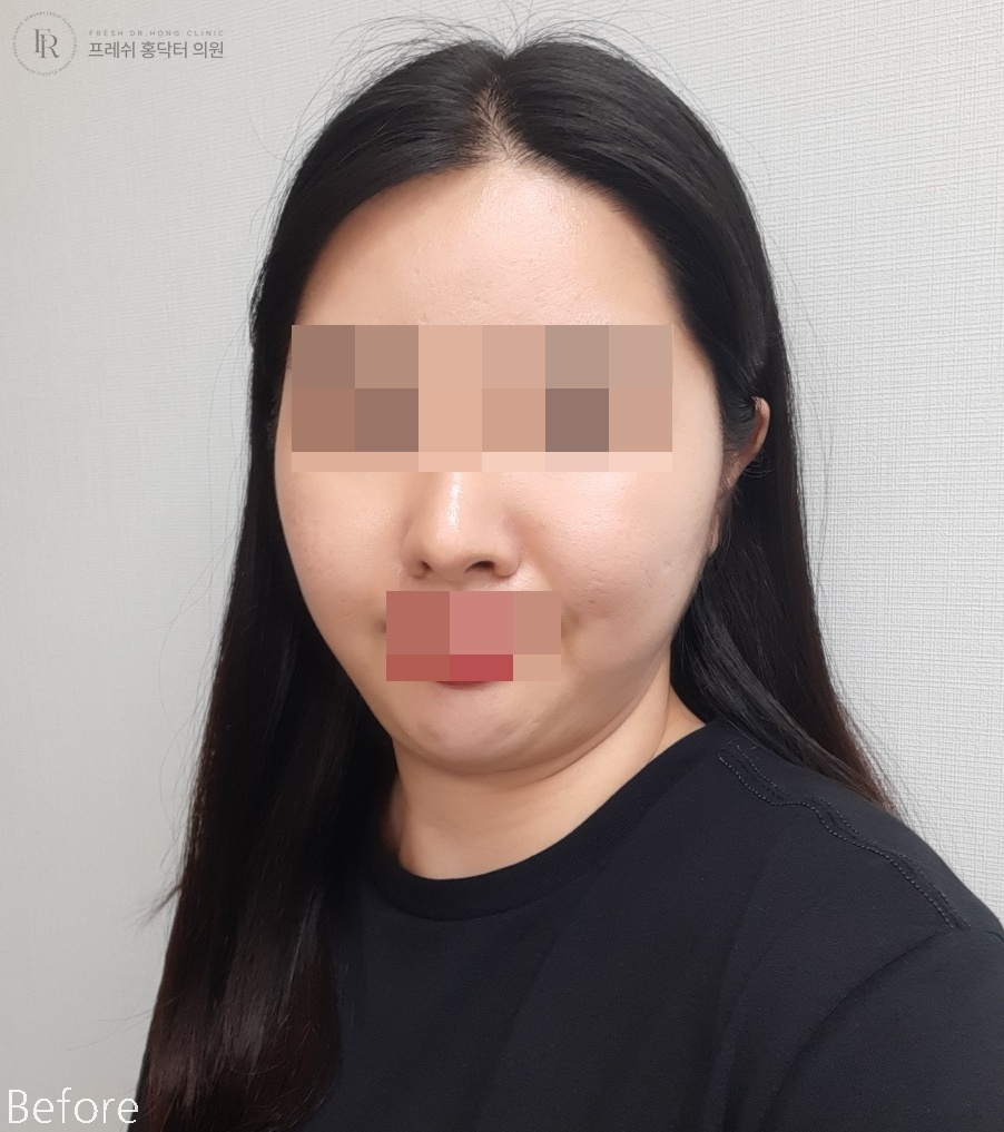 74d699094b67a155c2c55972202f7bc0_1773800010_1108.jpg 74d699094b67a155c2c55972202f7bc0_1773800010_1108.jpg