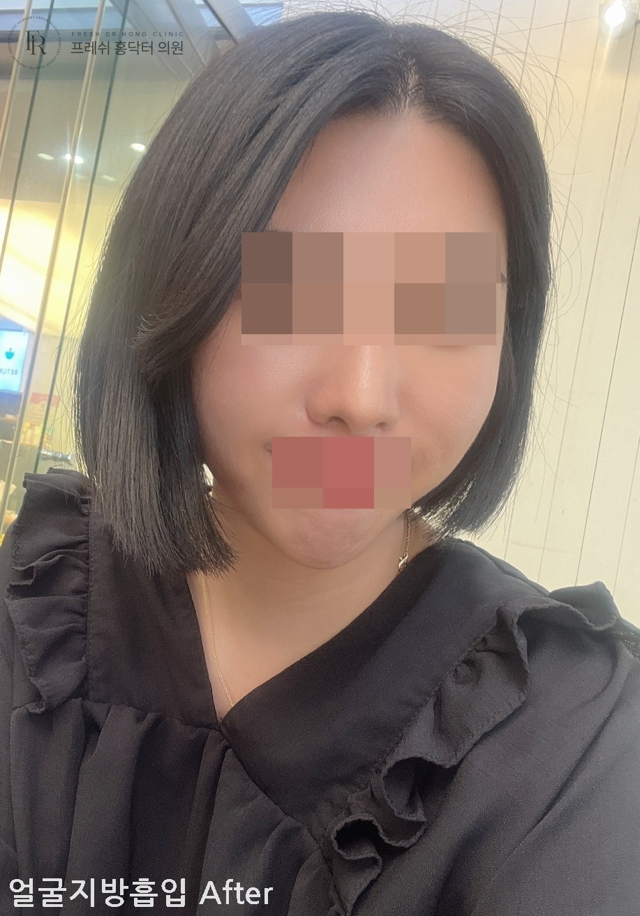 74d699094b67a155c2c55972202f7bc0_1773800010_5167.jpg 74d699094b67a155c2c55972202f7bc0_1773800010_5167.jpg