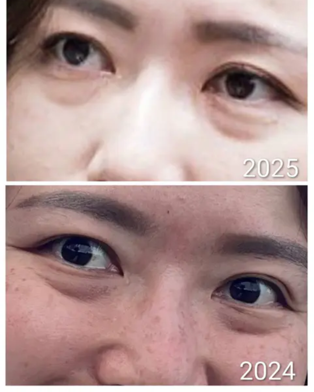 f08bbe1c48b0b37e10bcced474ed4a37_1774513837_5964.png f08bbe1c48b0b37e10bcced474ed4a37_1774513837_5964.png