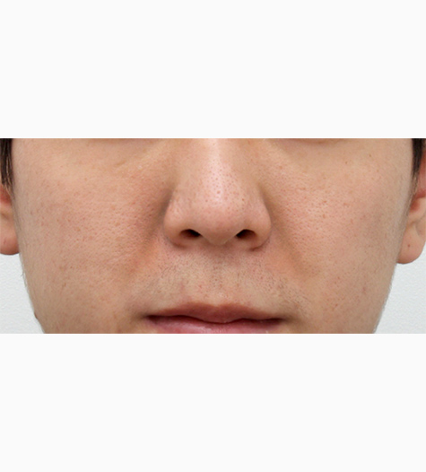 Before Image