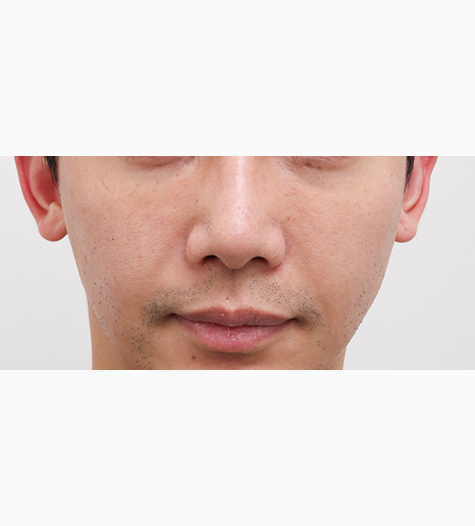 Before Image