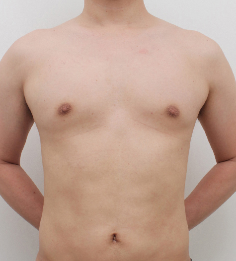 Before Image