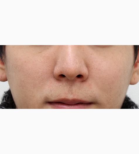 Before Image