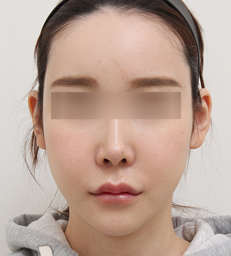 Before Image