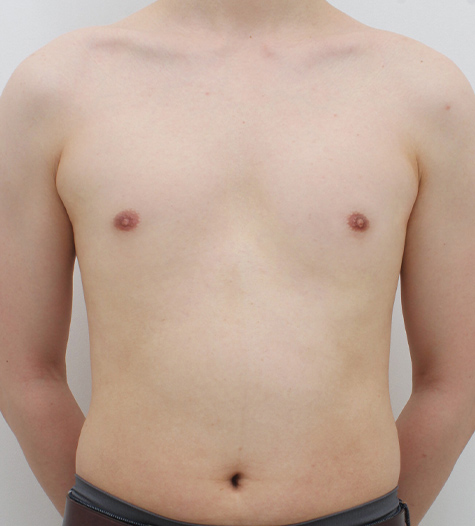 Before Image