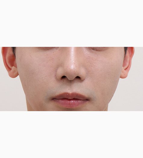 Before Image