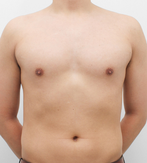 Before Image