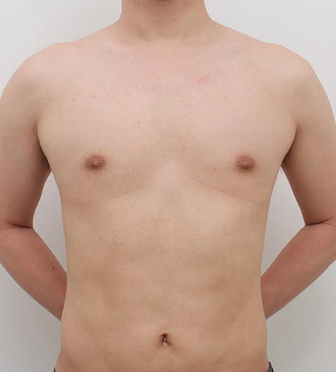 Before Image