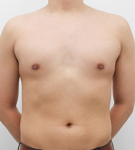 Before Image