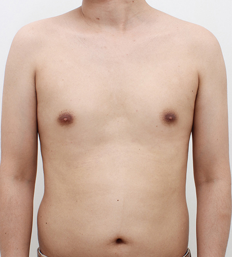 Before Image