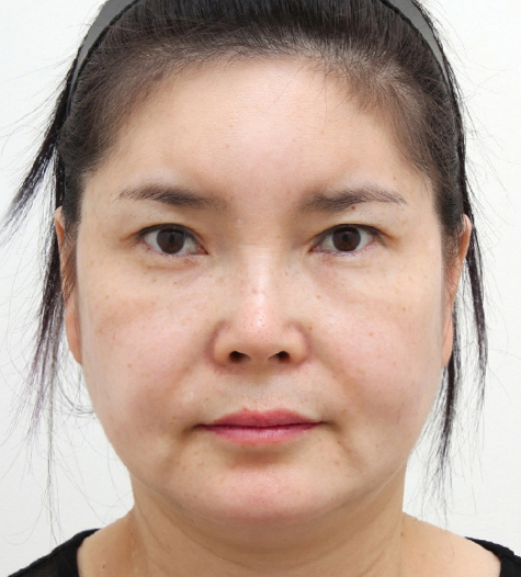 Before Image