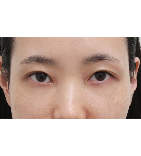 Before Image