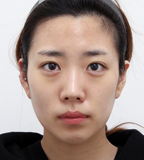 Before Image