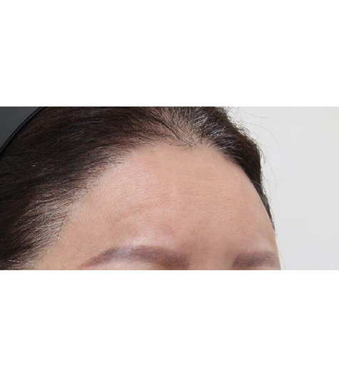 Before Image 3