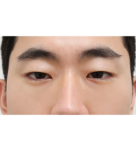 Before Image
