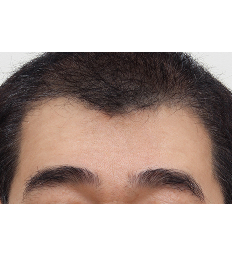 Before Image