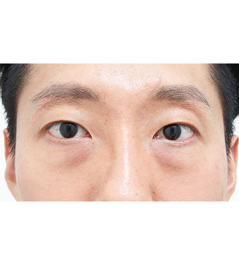 Before Image