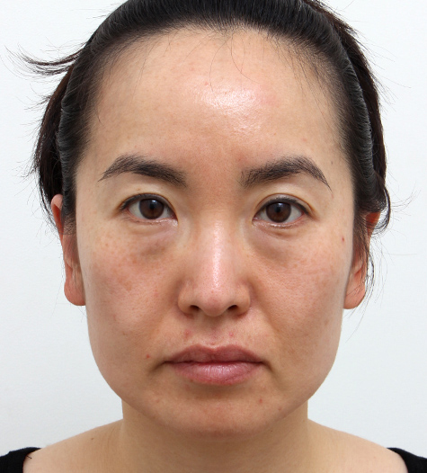 Before Image