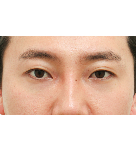 Before Image