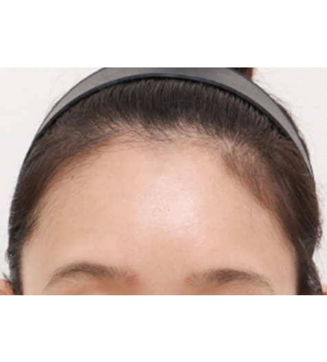 Before Image
