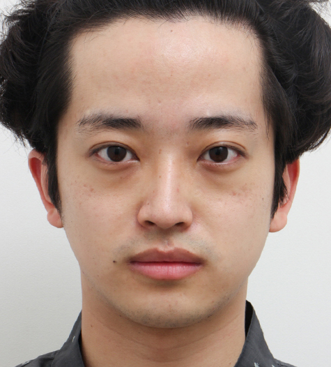 Before Image