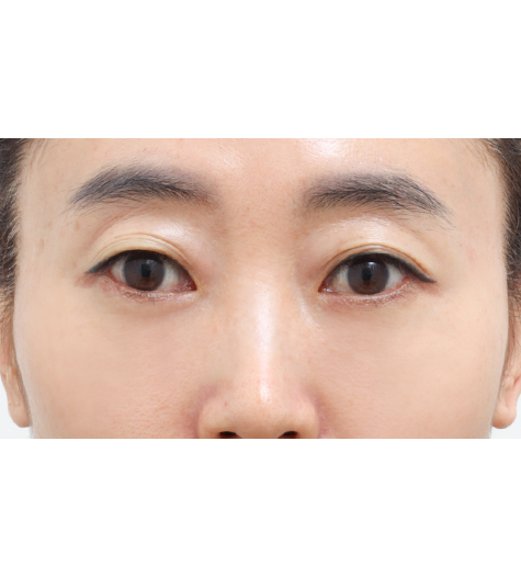 Before Image