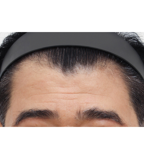Before Image