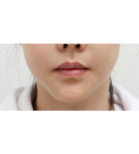 Before Image