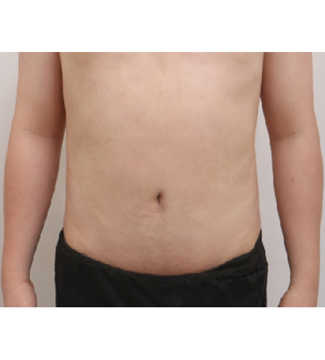 Before Image