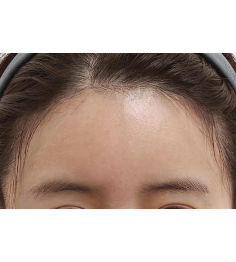 Before Image