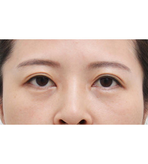 Before Image