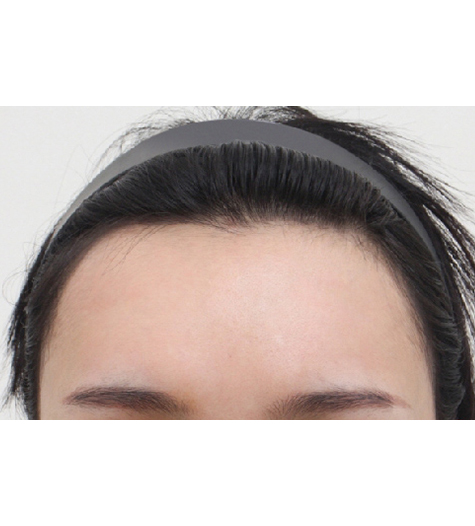 Before Image 4