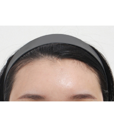 Before Image 4