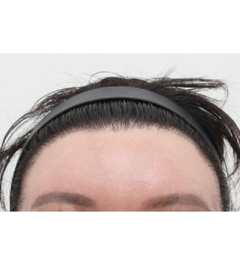 Before Image 4