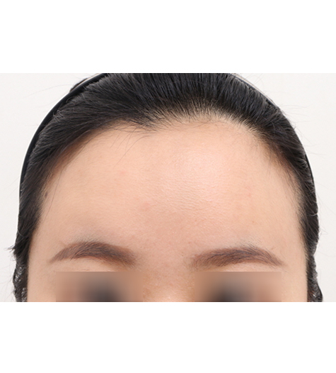 Before Image 4