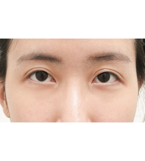 Before Image