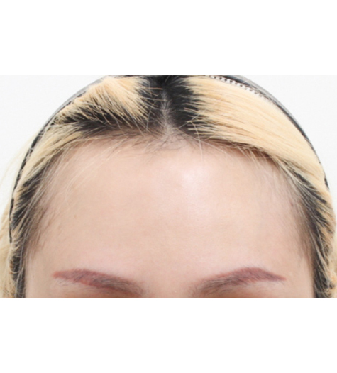 Before Image 4
