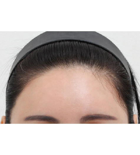 Before Image 4