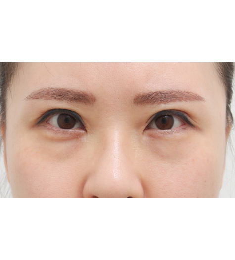 Before Image