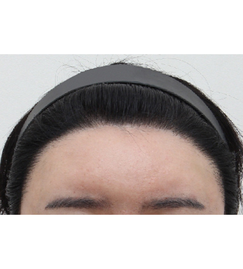 Before Image 3