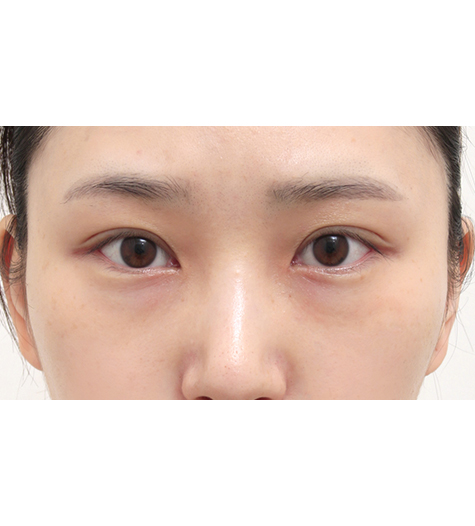 Before Image