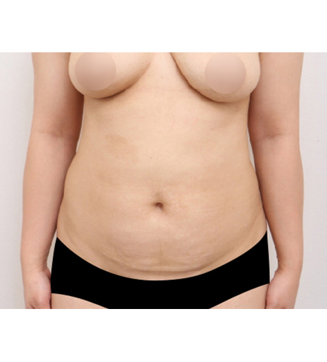 Before Image