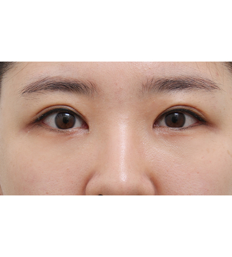 Before Image