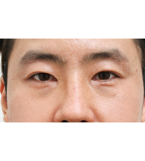 Before Image