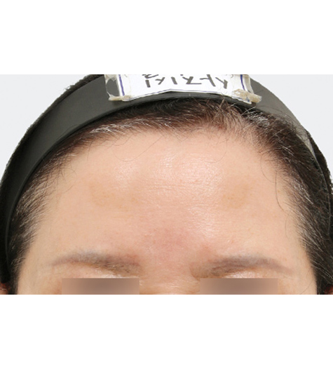 Before Image