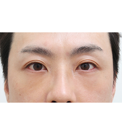 Before Image